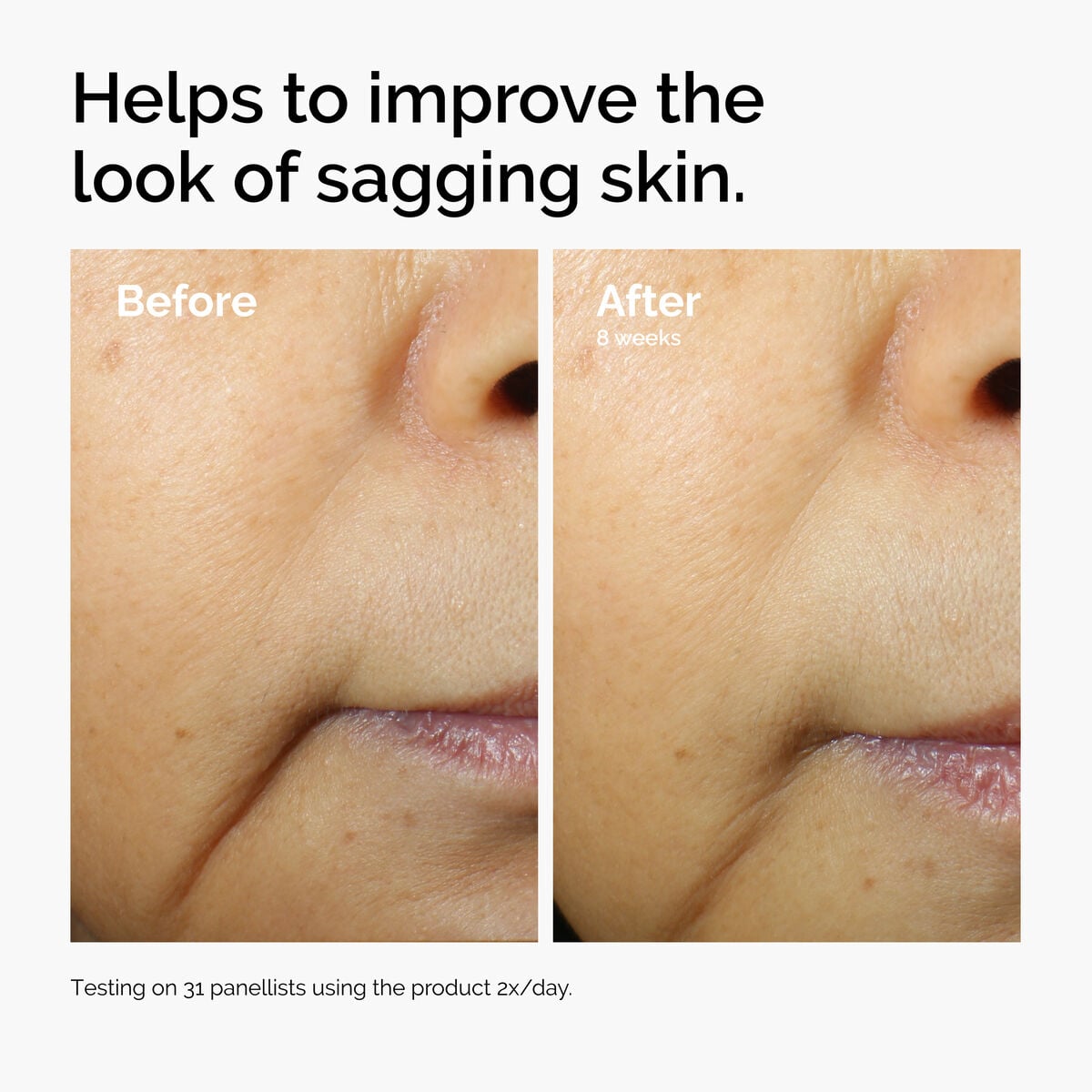 caffeine-3-escin-1-face-serum-i3 ord-caffeine-3pct-escin-1pct-face-serum-before-after-sagging.jpg