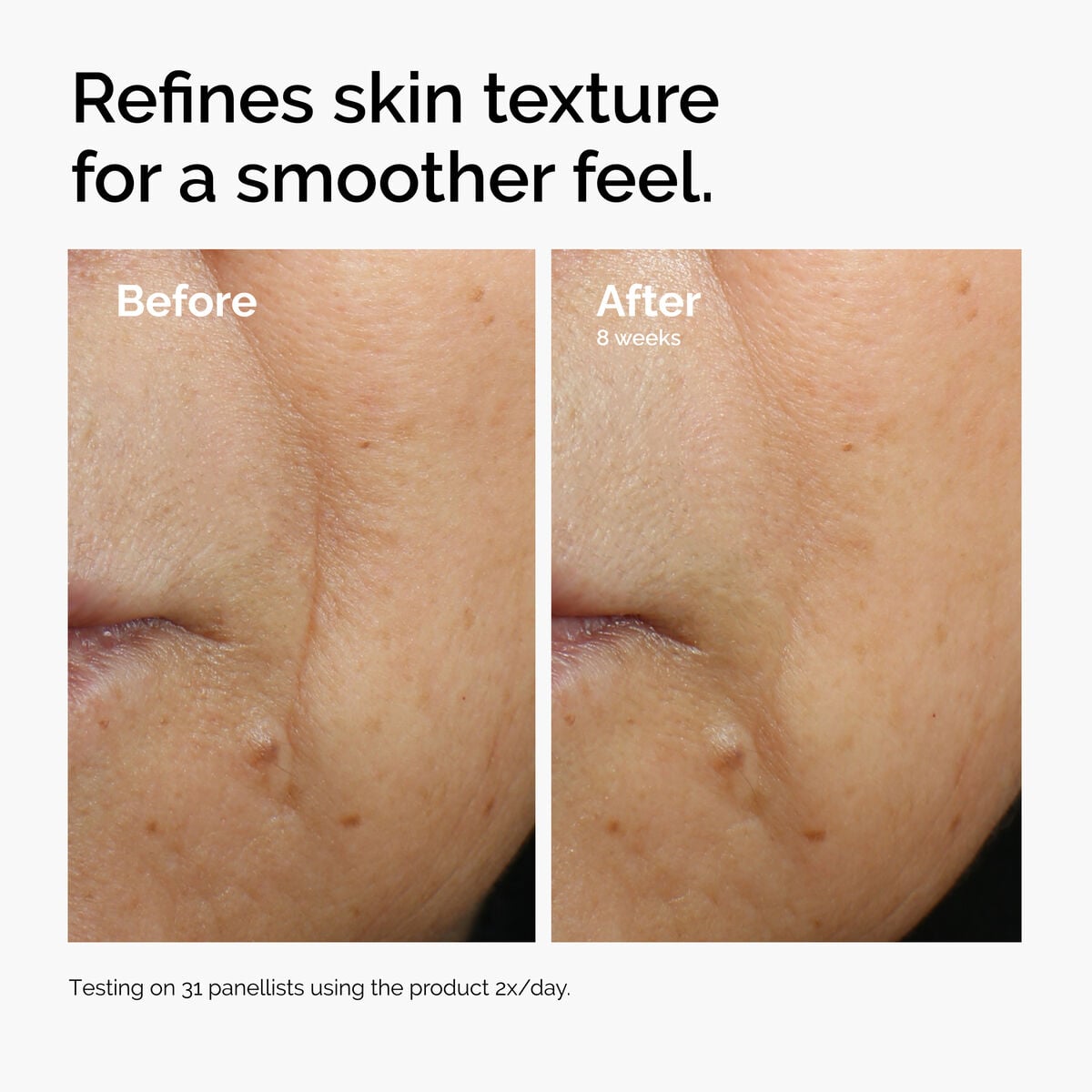 caffeine-3-escin-1-face-serum-i3 ord-caffeine-3pct-escin-1pct-face-serum-before-after-texture.jpg