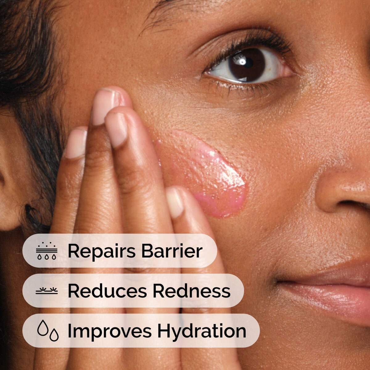 soothing-and-barrier-support-serum-u1 ord-soothing-barrier-support-serum-model-application-with-benefits.jpg